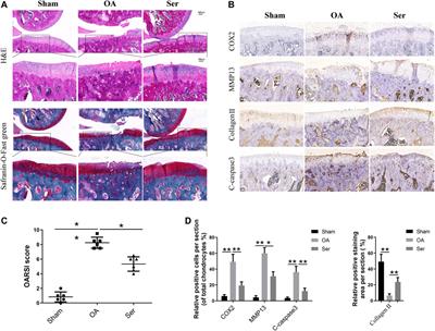 Selonsertib Alleviates the Progression of Rat Osteoarthritis: An in vitro and in vivo Study